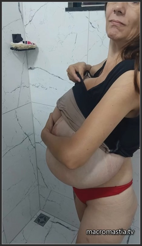 Gigantomastia