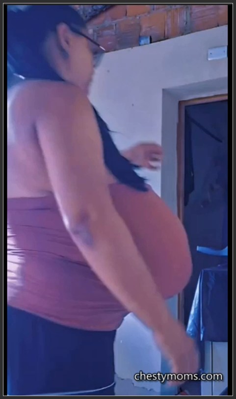 gigantomastia tits
